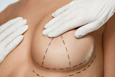 Elevación de senos